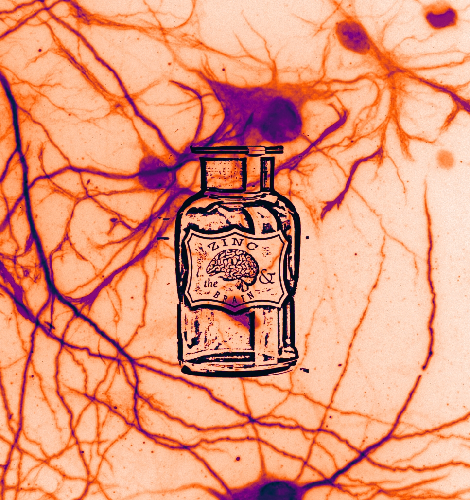 Understanding the role of zinc and zinc transporters in Autism